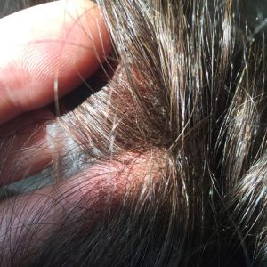 protesi-capelli-online
