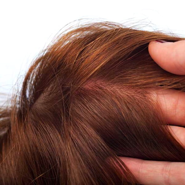 Protesi Capelli Donna 3D-2269