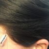 parrucca alopecia totale farcaphair
