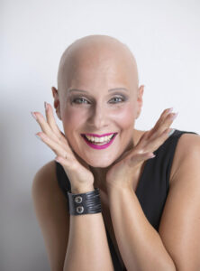 alopecia alopecia