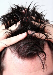protesi capelli in lace