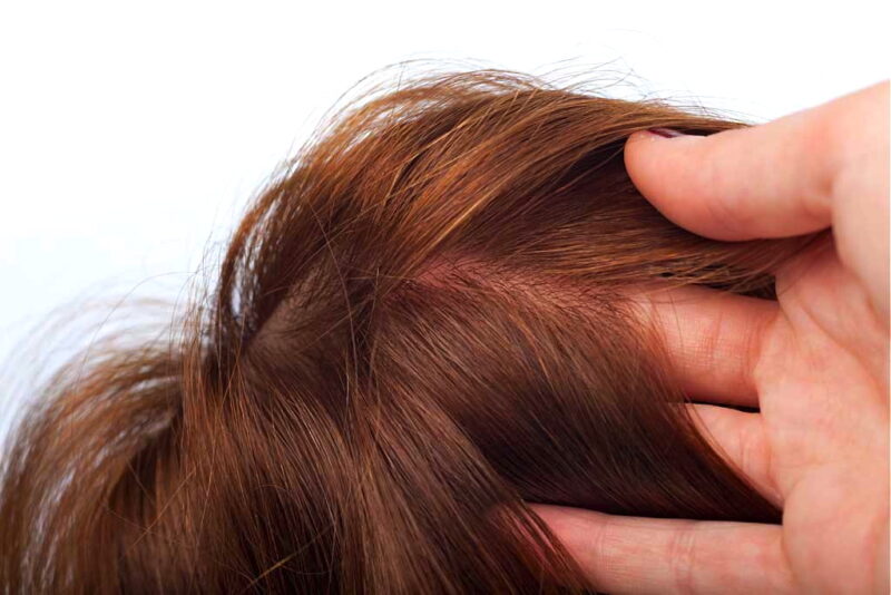 Protesi Capelli Donna 3D-2269