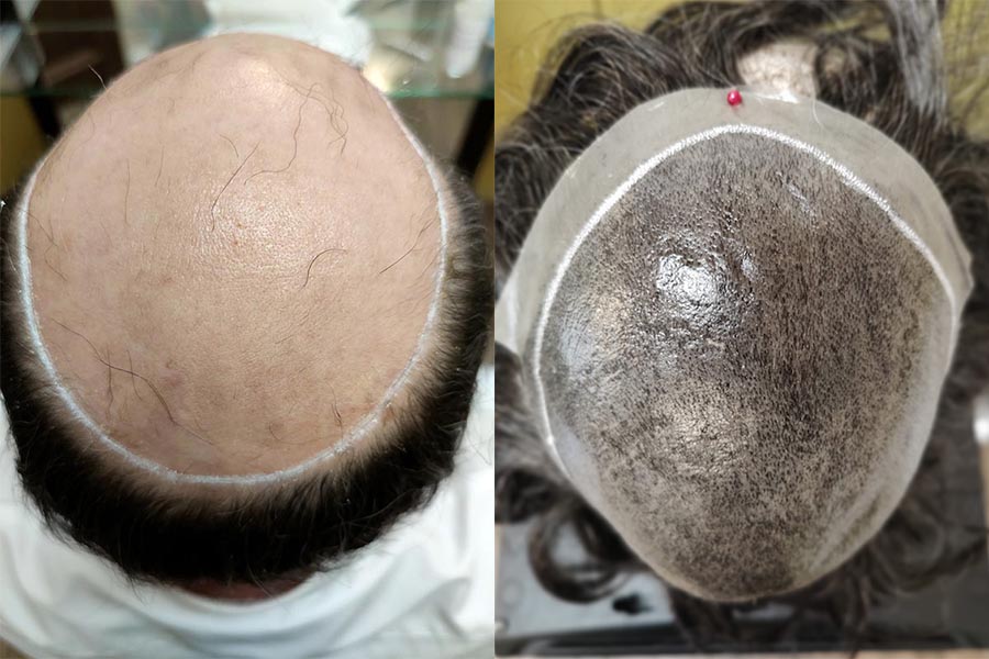 Come modificare una protesi di capelli